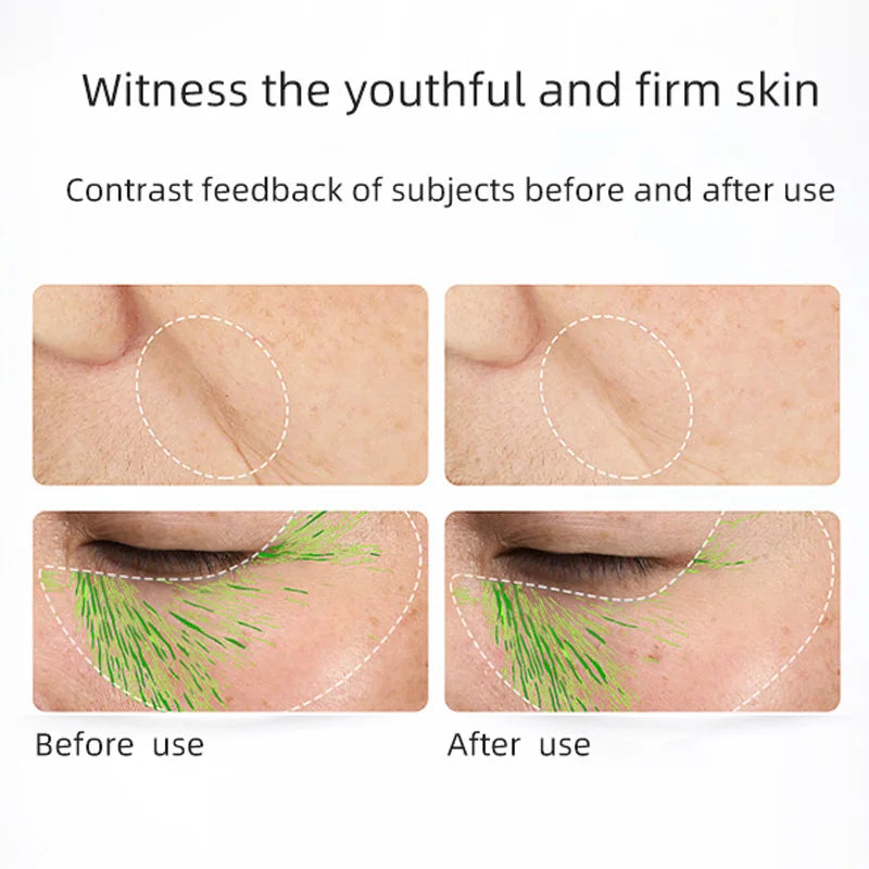 Murad Retinol Youth Renewal Serum - Fast-Acting Retinol Serum 30ml