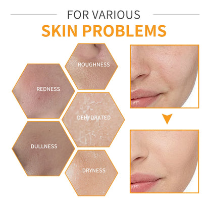 LAKERAIN Vitamin C Enriched Skin Care Set